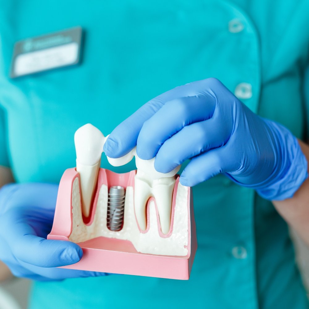 Sinus-Augmentation